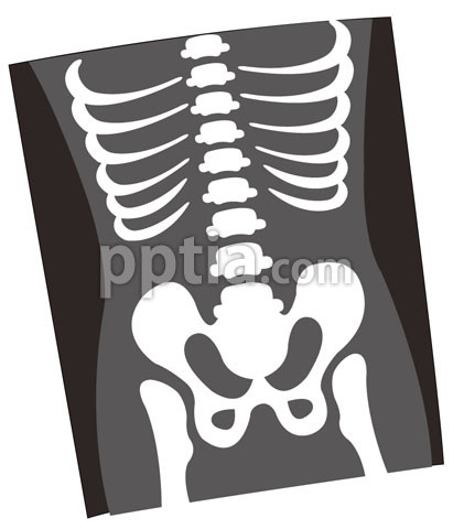X-ray 이미지 미리보기